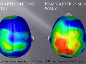 Reaktion des Gehirns auf Bewegung - Quelle: (c) Dr. C. Hillman